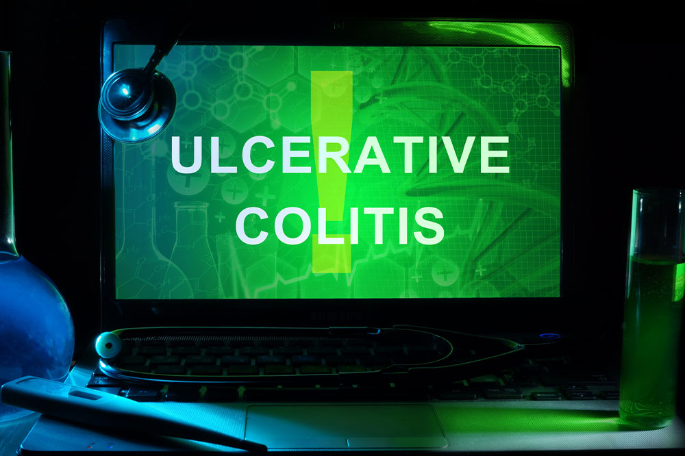 Symptoms and Foods to Avoid for Ulcerative Colitis
